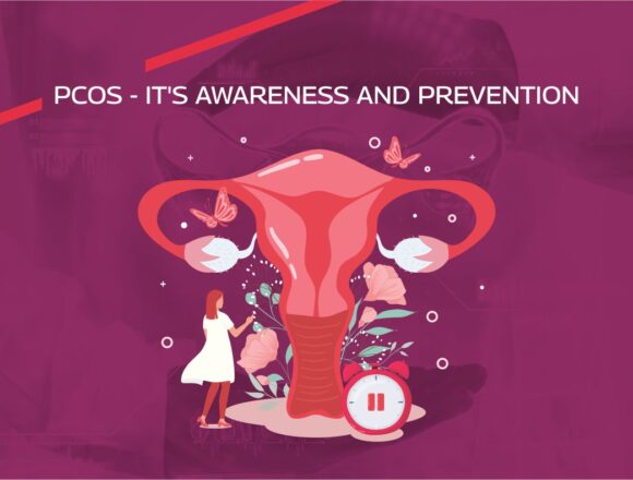 PCOS PCOS – It’s not her laziness, it’s exhaustion