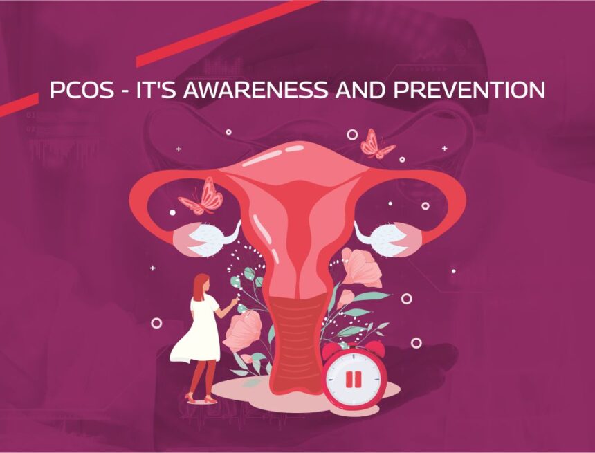 PCOS – It’s not her laziness, it’s exhaustion